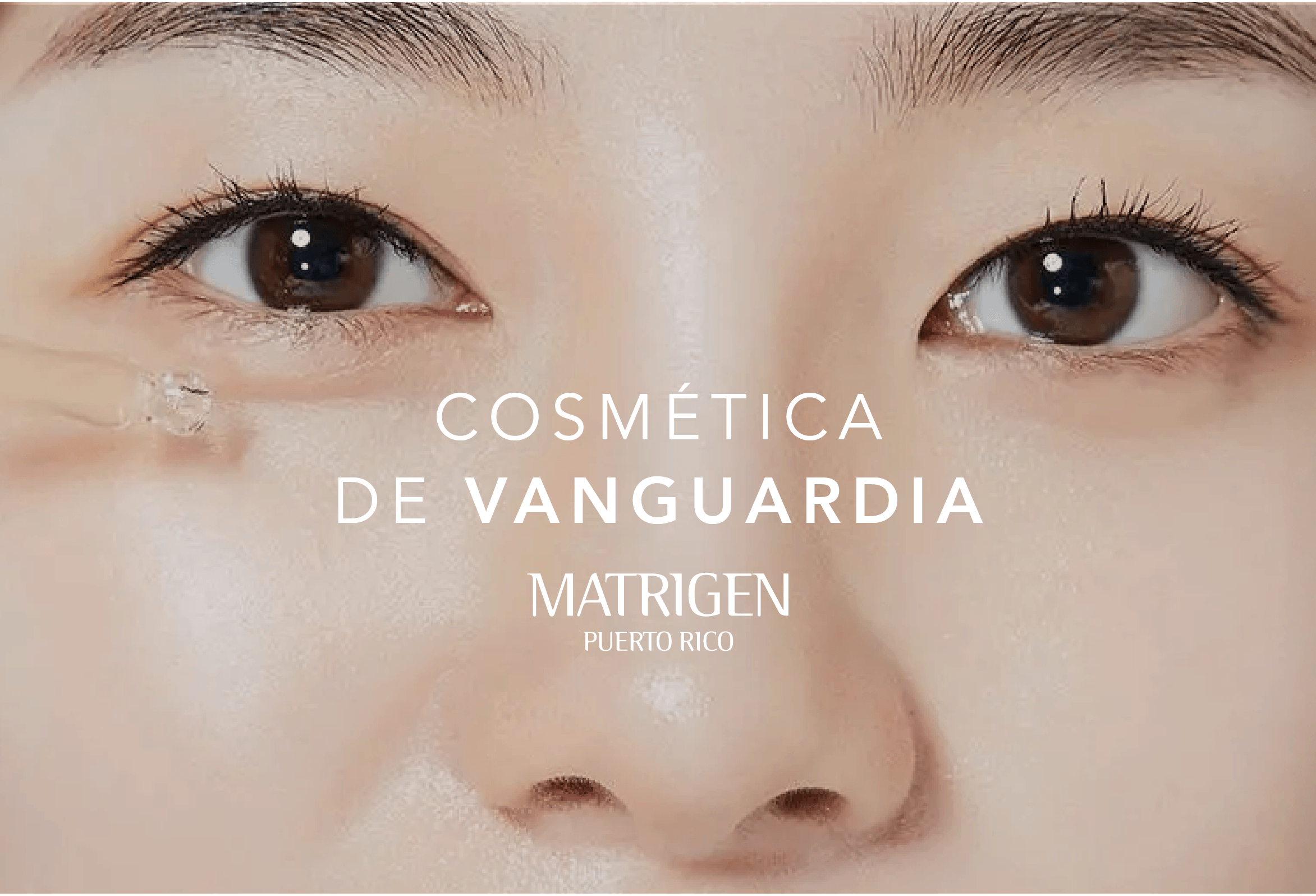 MATRIGEN PR